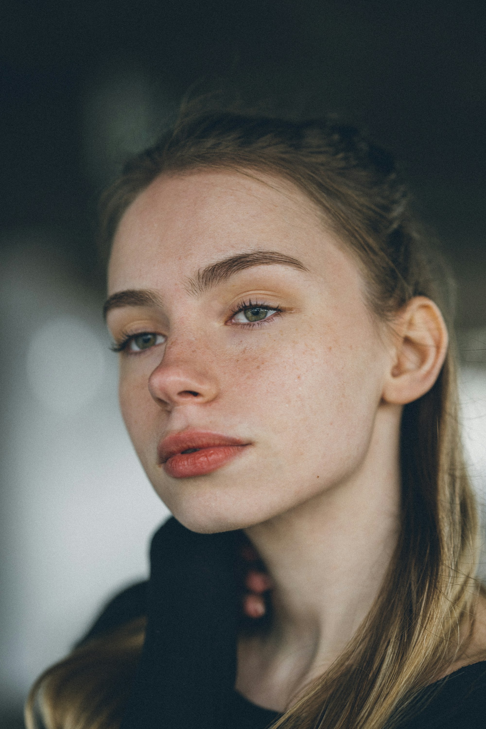 Melasma protocol