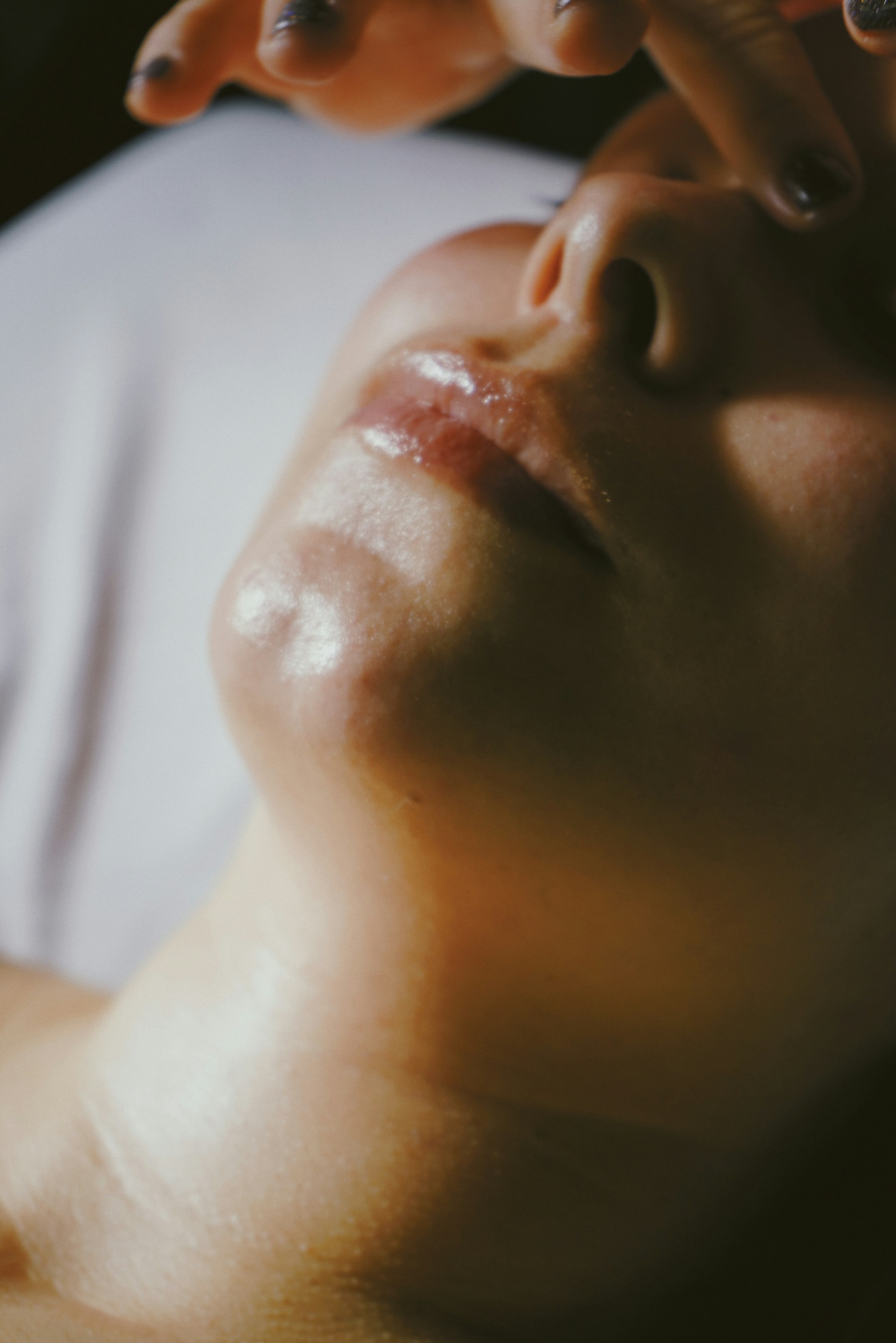 Botulinum toxin, upper face