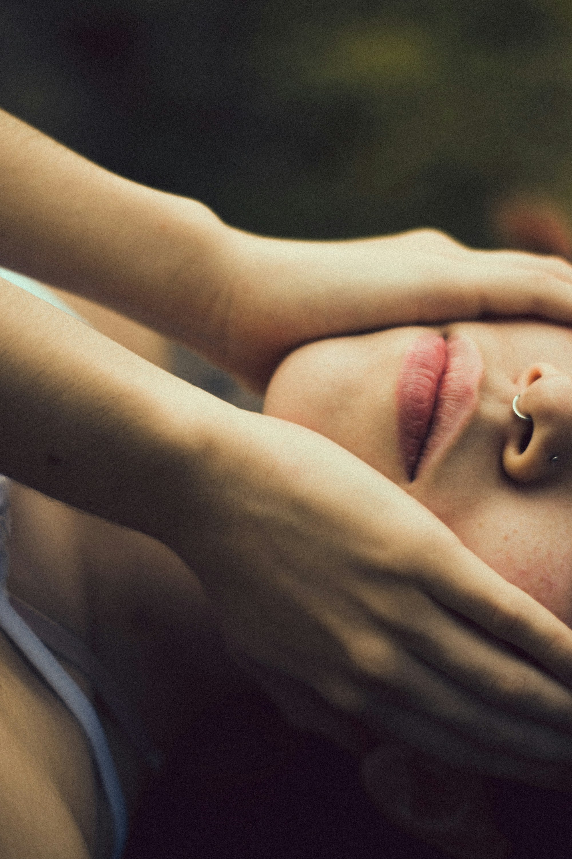 Microneedling with RF